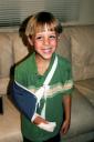  Our precious Jerome in his cast and sling.